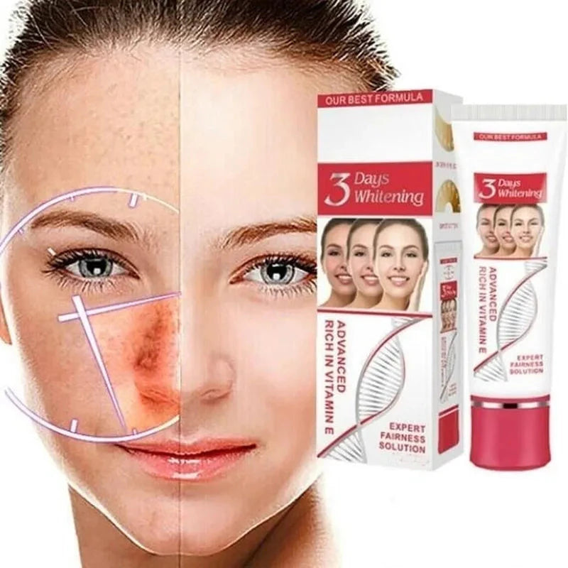 25g-os arckrém sötét foltok eltávolítáasára alkalmas Fade Blemish Melasma Kezelő Fehérítő Krém szeplőkre,arcápolássra.