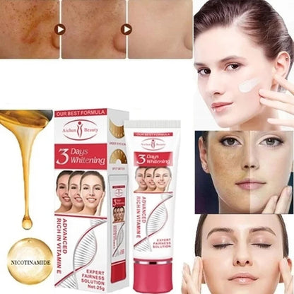 25g-os arckrém sötét foltok eltávolítáasára alkalmas Fade Blemish Melasma Kezelő Fehérítő Krém szeplőkre,arcápolássra.