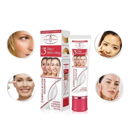 25g-os arckrém sötét foltok eltávolítáasára alkalmas Fade Blemish Melasma Kezelő Fehérítő Krém szeplőkre,arcápolássra.