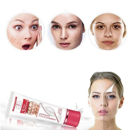 25g-os arckrém sötét foltok eltávolítáasára alkalmas Fade Blemish Melasma Kezelő Fehérítő Krém szeplőkre,arcápolássra.